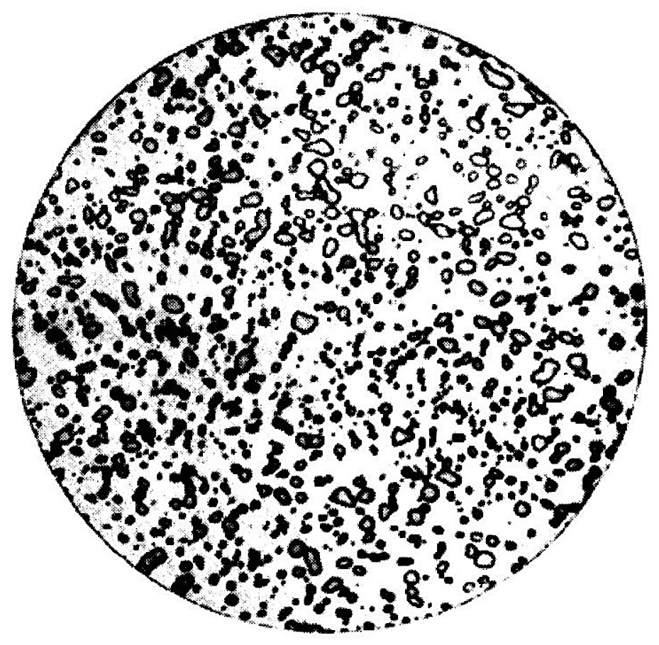 Spheroidized microstructure of a 1.0 percent carbon steel at 2000x magnification, globular carbide in a ferrite matrix